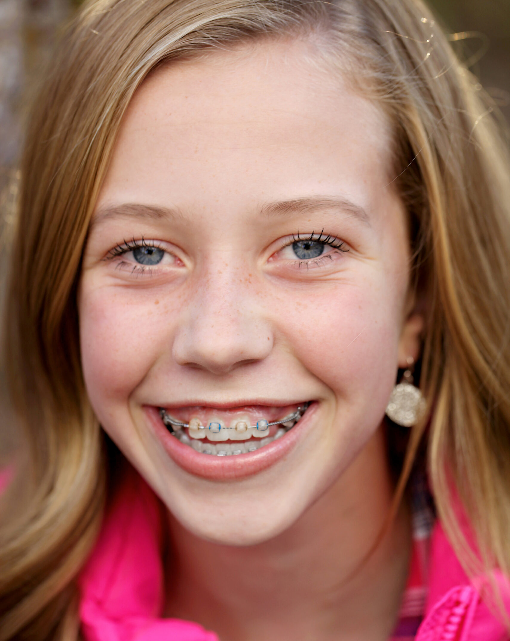 Orthodontic Treatment South Ogden Utah